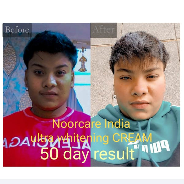 Noorcare Ultra Whitening Cream Night Cream