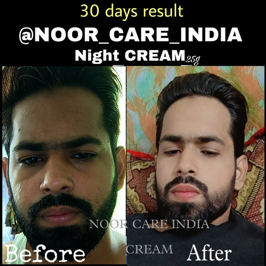 Noorcare Ultra Whitening Cream Night Cream